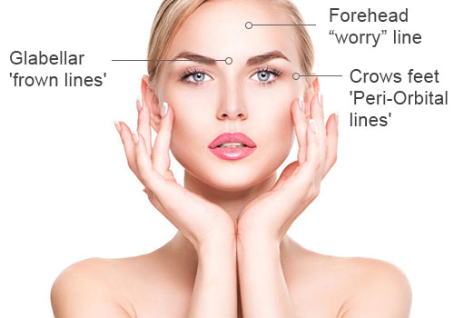 botox injections cyprus limassol nicosia.jpg